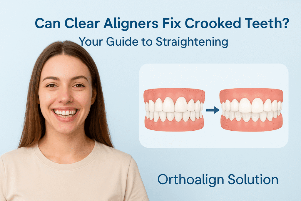 Can Clear Aligners Fix Crooked Teeth?