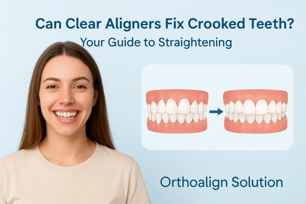 Can Clear Aligners Fix Crooked Teeth?