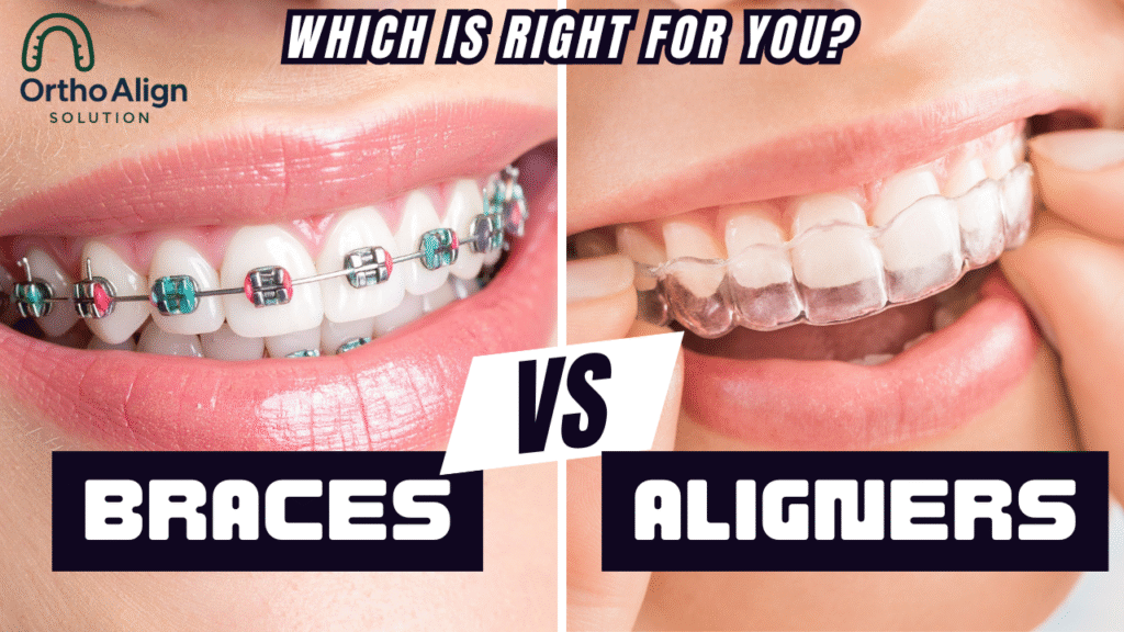 Aligner vs Braces: Invisible Confidence, Visible Results