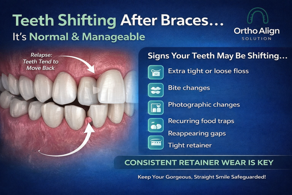 Why Do Teeth Sometimes Shift After Orthodontic Treatment?